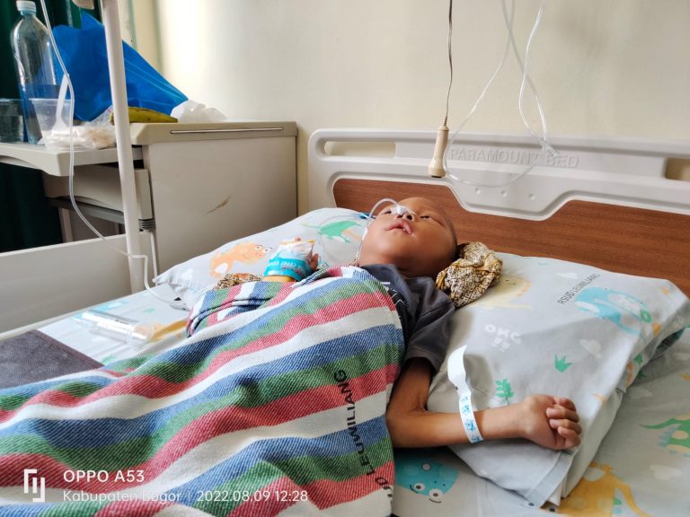 Gizi Buruk Diderita Anak Parungpanjang