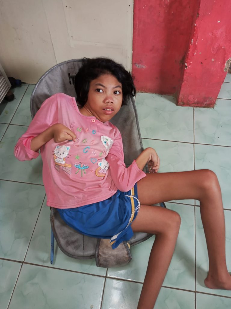 Cacat Sejak Lahir, Nasywa Butuh Bantuan Kursi Roda