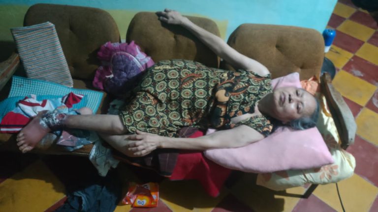 Keterbatasan Ekonomi, Warga Teluk Pinang Hanya Bisa Berbaring