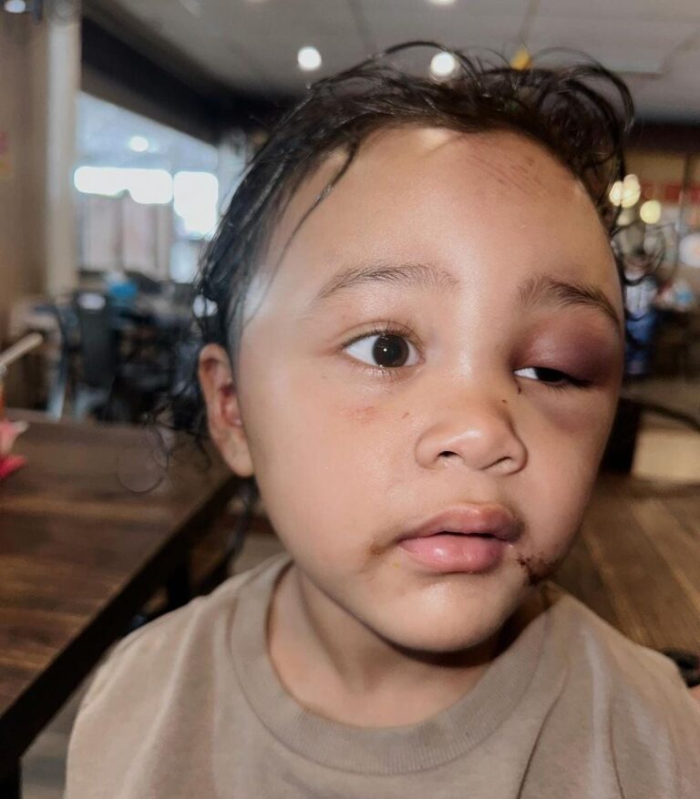 Viral! Anak Selebgram Malang Emy Aghnia Dianiaya Suster, Polisi Tangkap Pelaku